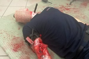 Pełna charakteryzacja ran policjanta na ramieniu i szyi - rany od noża.