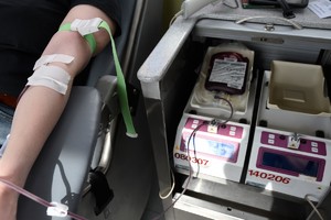Zbliżenie na rękę podczas pobierania krwi oraz na maszyne ponierająca krew